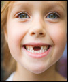 سلامت دندان دائمی کودک در گرو سلامت دندان شیری